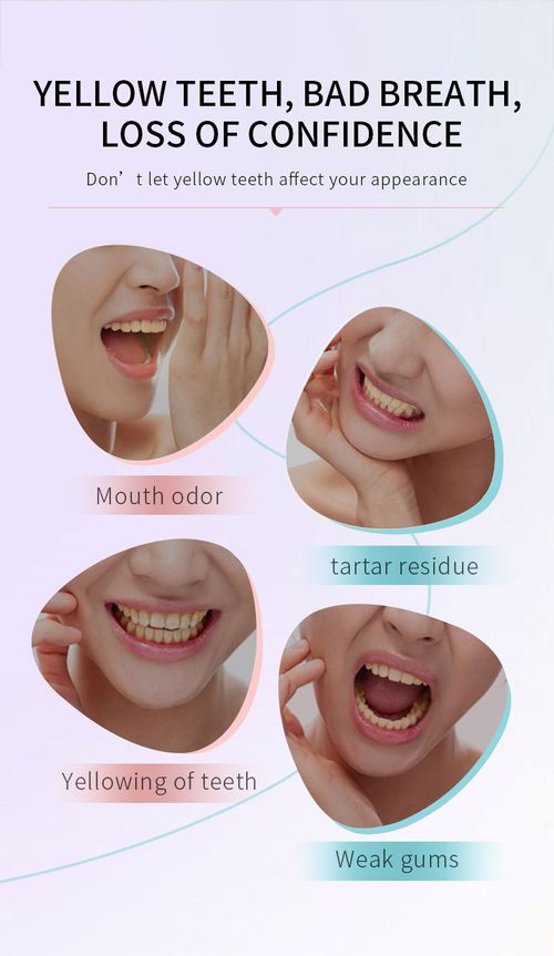 Hanlun Meiyu Niacinamide Whitening Toothpaste — Cleanses Mouth, Removes Stains, Freshens Breath, Long-Lasting Fragrance