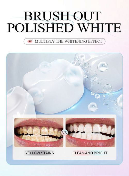 Hanlun Meiyu Niacinamide Whitening Toothpaste — Cleanses Mouth, Removes Stains, Freshens Breath, Long-Lasting Fragrance