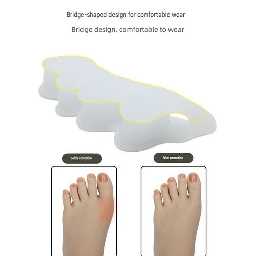 Five-Hole Toe Separator and Corrector