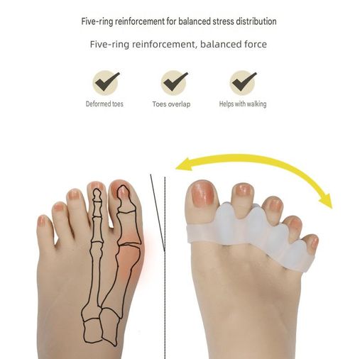 Five-Hole Toe Separator and Corrector