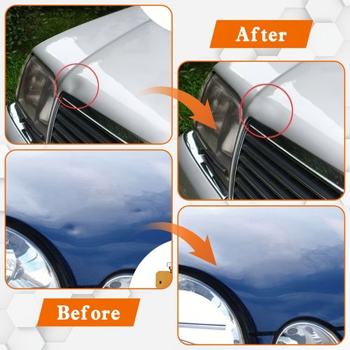 Auto Paintless Body Dent Removal Remover Kits