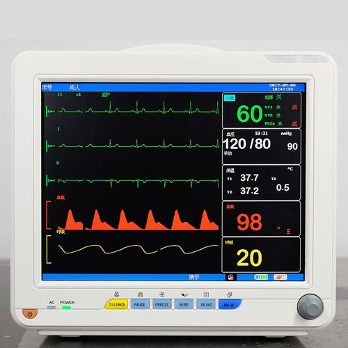 Medical ECG Monitor