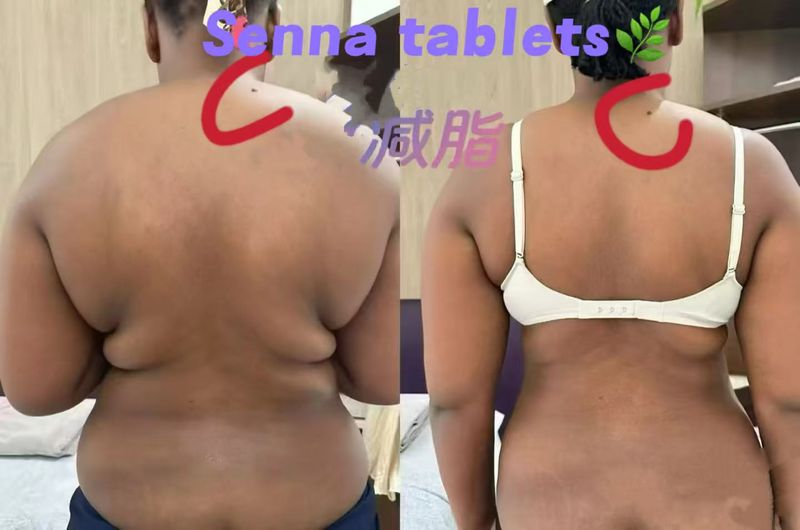 Comprimidos de Sene para Emagrecimento - Elimina Gordura em 3 Passos | Seguro e Natural