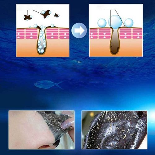 Aichun Beauty Black Facial Mask Brighteens Complex + Free Black Head