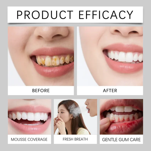 Whiter Smile Tooth Powder(3 bottles)
