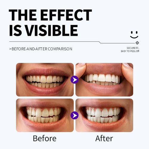 DDBSHIY Purple Teeth Whitening Strips  Whitening Sessions Non Sensitive Teeth Whitening