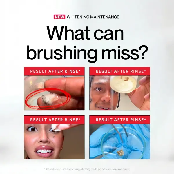 Whitening Mouthwash – Removes Stains, Freshens Breath, 237ml