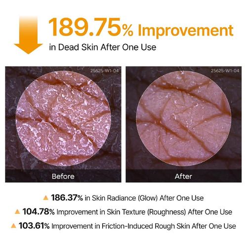 Dr.Melaxin Official Peel Shot Keratin Care Kojic Acid Turmeric Spray 200ml Pore Clearing Exfoliating Formula Skin Repair Scrub