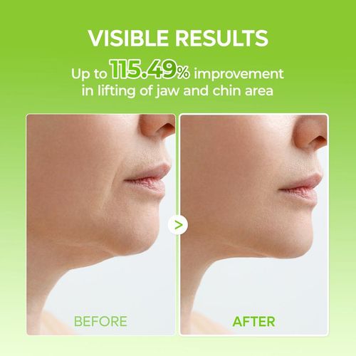 🌵Cactus Cooling Lifting & Firming Shaping Band: Reduces puffiness, minimizes pores, and repairs skin.