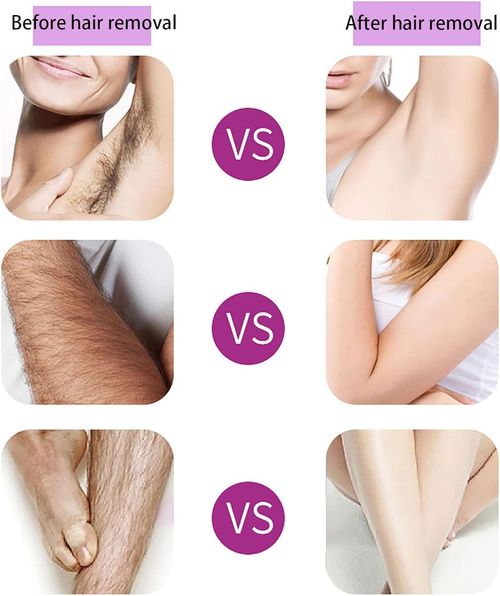 Finishing Painless Hair Remover