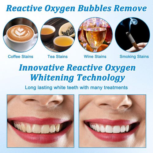Teeth Whitening Strips, 28 Sensitive Teeth Whitening Individual Strips for Fast Yellowing Removal