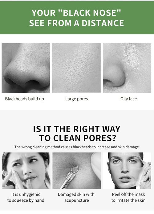 🌿 Say Goodbye to Shiny & Oily Skin! The Ultimate Green Tea Cleansing Stick for Oily & Acne-Prone Skin. 🧖‍♀️🧖‍♂️