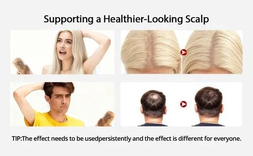 🔥Hot Seller🔥 COD！New Red and Blue Light Hair Care Device, Red Light Therapy Cap, Portable Hair Care Device, Hair Care Helmet, Laser Hair Care, Cross-Border
