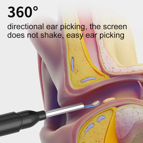 🔥🔥🔥Durable Ear Wax Removal Easy to Operate Visual Electric Earpick Camera Wireless Ear Cleaner With Otoscope