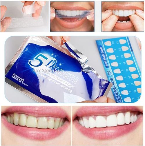 Teeth Whitening Strips