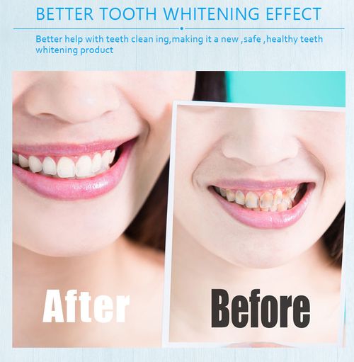 Mint-Flavored Coconut Shell Activated Charcoal Teeth Whitening Powder