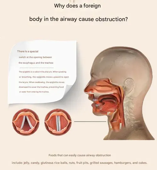 Heimlich maneuver device, negative pressure suction device, anti-choking and anti-suffocation instruments, and airway emergency tools with face masks.