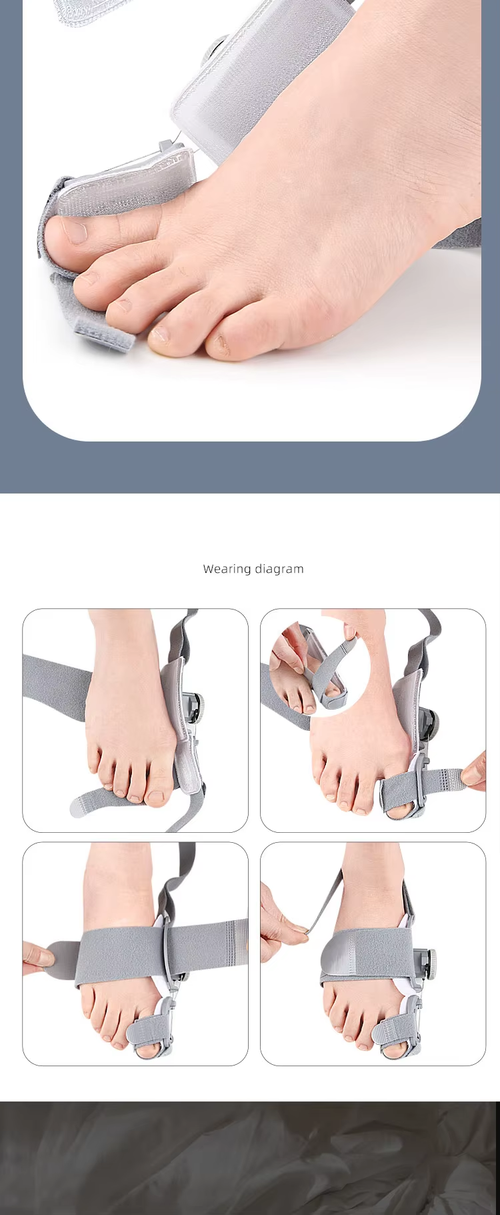 toe straightener