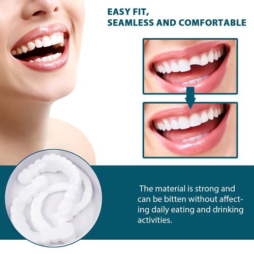 Adjustable denture set, perfect fit, whitens teeth, snap-on silicone portable denture aligner, fills gaps between teeth, smile veneers.