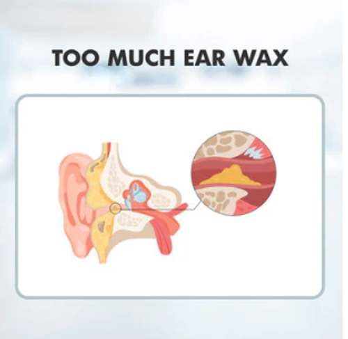 Sound Increaser for Ear (HE01)