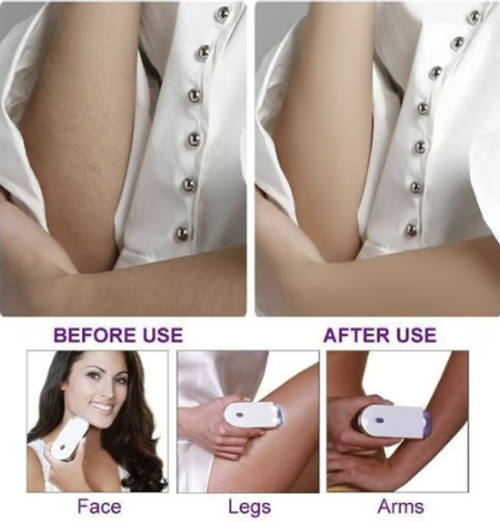 🔥BIG SALE - 49% OFF🔥 Silky Smooth Hair Eraser