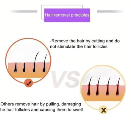 🔥BIG SALE - 49% OFF🔥 Silky Smooth Hair Eraser