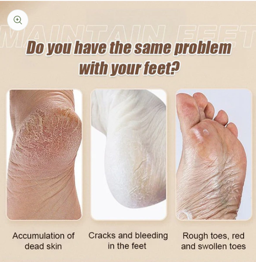 🔋🦶Rechargeable Electric Foot Exfoliating Scrubber🌟 Gently Exfoliates, Smooths Feet, Essential for Home Pedicures!