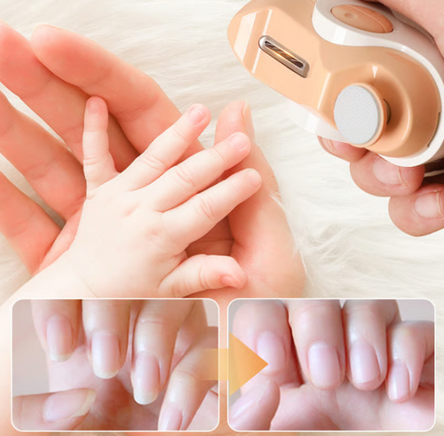 ✨ Electric Safe Nail Clipper｜Automatic Trimming · Safe for Children · Perfect for the Whole Family