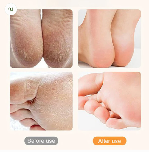 🔋🦶Rechargeable Electric Foot Exfoliating Scrubber🌟 Gently Exfoliates, Smooths Feet, Essential for Home Pedicures!