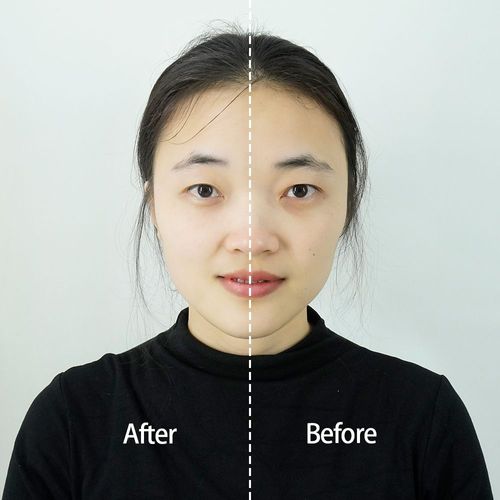 Awaken your youthful skin overnight, and freeze the radiant collagen feeling in one tear. Skin becomes firmer, more elastic, and regains its radiance.