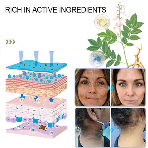 It is like giving your skin a thorough cleaning, absorbing deep-seated dirt, polishing and resurfacing, and instantly restoring clean matte skin.