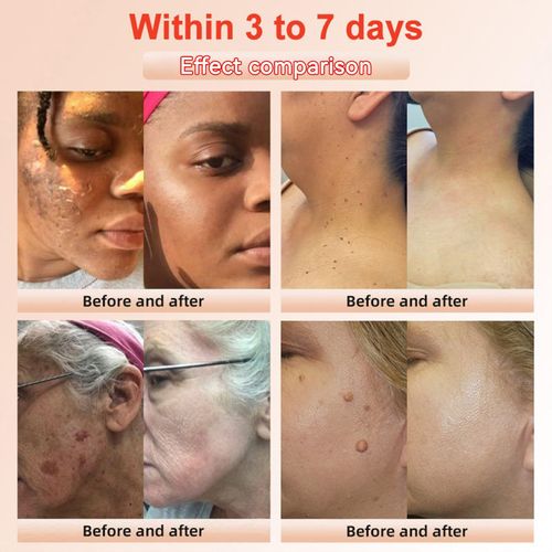 It is like giving your skin a thorough cleaning, absorbing deep-seated dirt, polishing and resurfacing, and instantly restoring clean matte skin.
