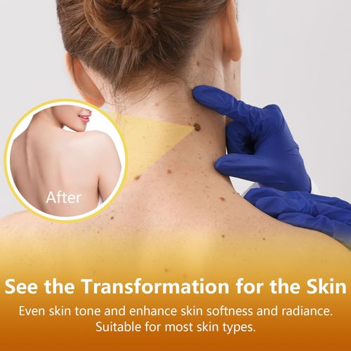 Bee Venom Body Care Spray, joint comfort massage spray for neck, shoulder, back, knee, arm, and leg daily care, smooth skin body spray for home massage and personal care, easy spray bottle, COD Free Shipping, Pay on Delivery
