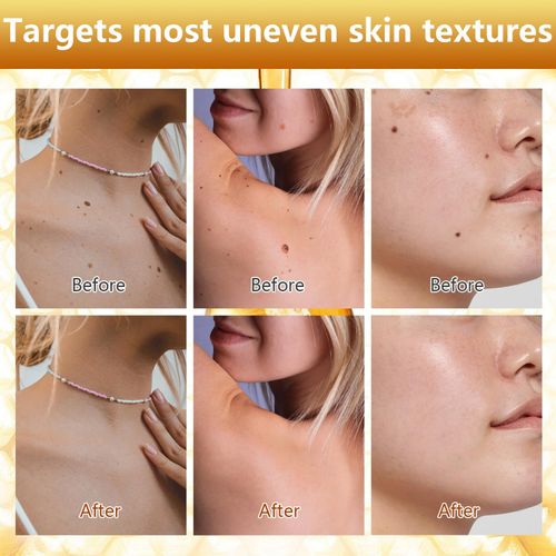 Bee Venom Body Care Spray, joint comfort massage spray for neck, shoulder, back, knee, arm, and leg daily care, smooth skin body spray for home massage and personal care, easy spray bottle, COD Free Shipping, Pay on Delivery