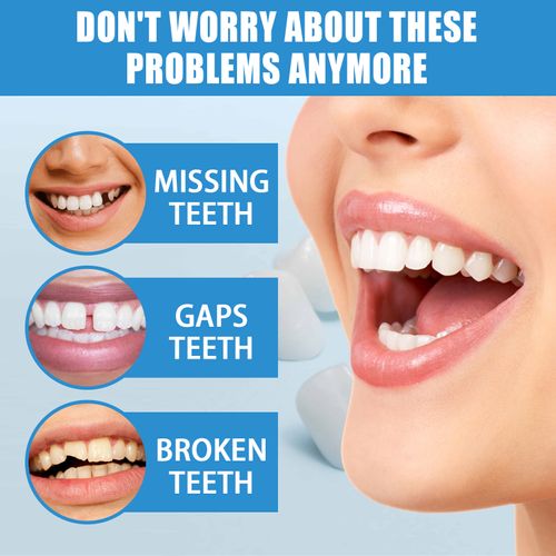 Moldable False Teeth Thermal Beads, Temporary Tooth Repair Material for Cosmetic Smile Decoration