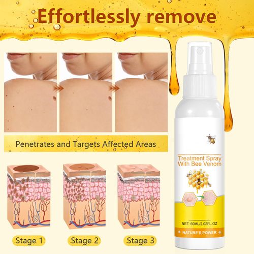 Bee Venom Body Care Spray, joint comfort massage spray for neck, shoulder, back, knee, arm, and leg daily care, smooth skin body spray for home massage and personal care, easy spray bottle, COD Free Shipping, Pay on Delivery