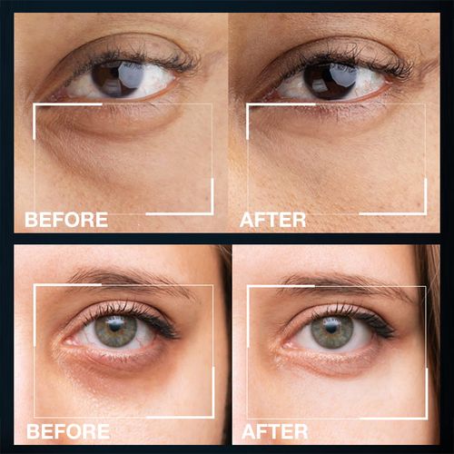 BUY 1 TAKE 1  Advanced Eyebag Cream  Eliminate eye bags  Reduce fine lines  Lighten dark circles