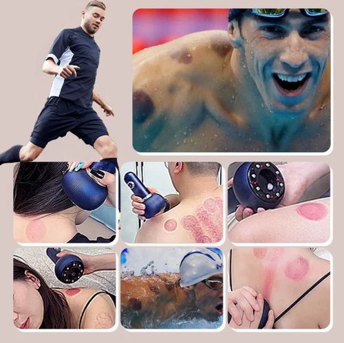 ⌛Electric Cupping Therapy Massager &amp; Meridian Brush Set