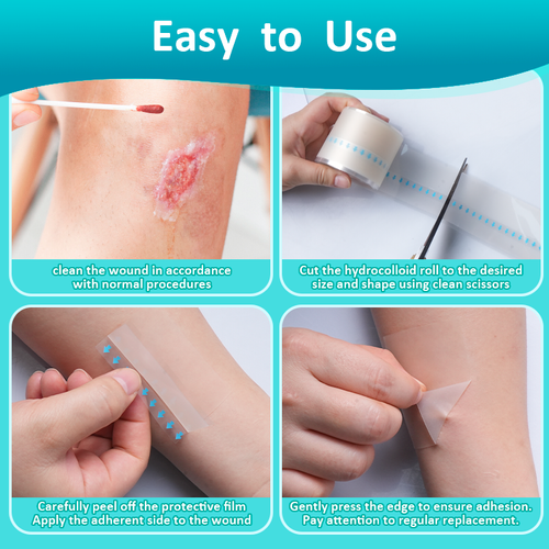 Flexible Hydrocolloid Roll Dressing Disposable Moist Healing Waterproof Skin-Friendly Wound Care