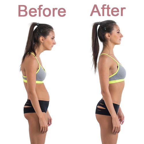 Cross Corrector Hunchback Corrector Yoga Hunchback Posture Corrector Adjustable Yoga Sticks Stretching Tool Gymnastics Body Shaping Equipment