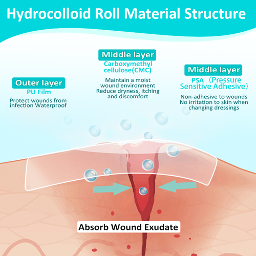 Flexible Hydrocolloid Roll Dressing Disposable Moist Healing Waterproof Skin-Friendly Wound Care
