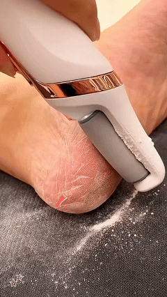 Electric Foot File – Dead Skin Remover, USB Rechargeable, 3 Interchangeable Heads for Smooth Feet | Foot Care Tool