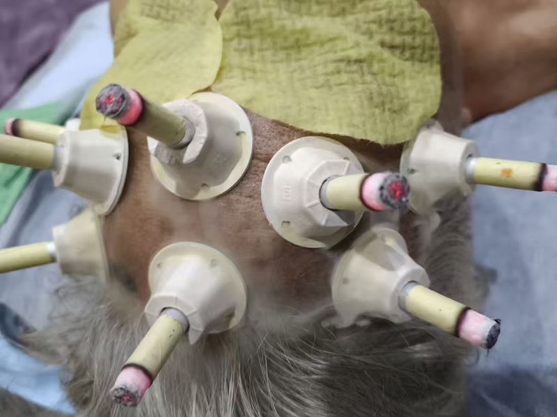 体验艾灸式养护  帮助改善暂时性身体浮肿  舒缓疲劳  获得深度放松   Enjoy moxibustion‑inspired wellness, help reduce temporary water‑retention puffiness and relieve fatigue for deep relaxation.