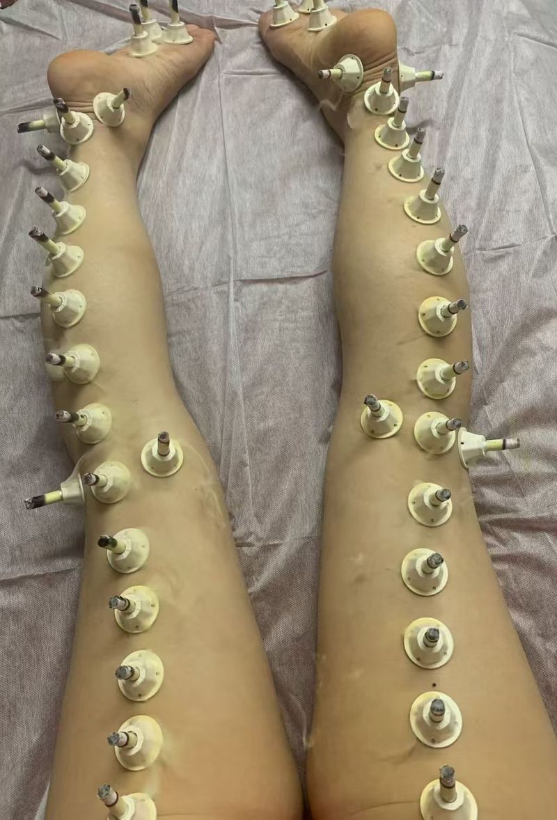 体验艾灸式养护  帮助改善暂时性身体浮肿  舒缓疲劳  获得深度放松   Enjoy moxibustion‑inspired wellness, help reduce temporary water‑retention puffiness and relieve fatigue for deep relaxation.