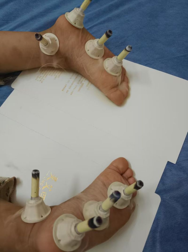 体验艾灸式养护  帮助改善暂时性身体浮肿  舒缓疲劳  获得深度放松   Enjoy moxibustion‑inspired wellness, help reduce temporary water‑retention puffiness and relieve fatigue for deep relaxation.