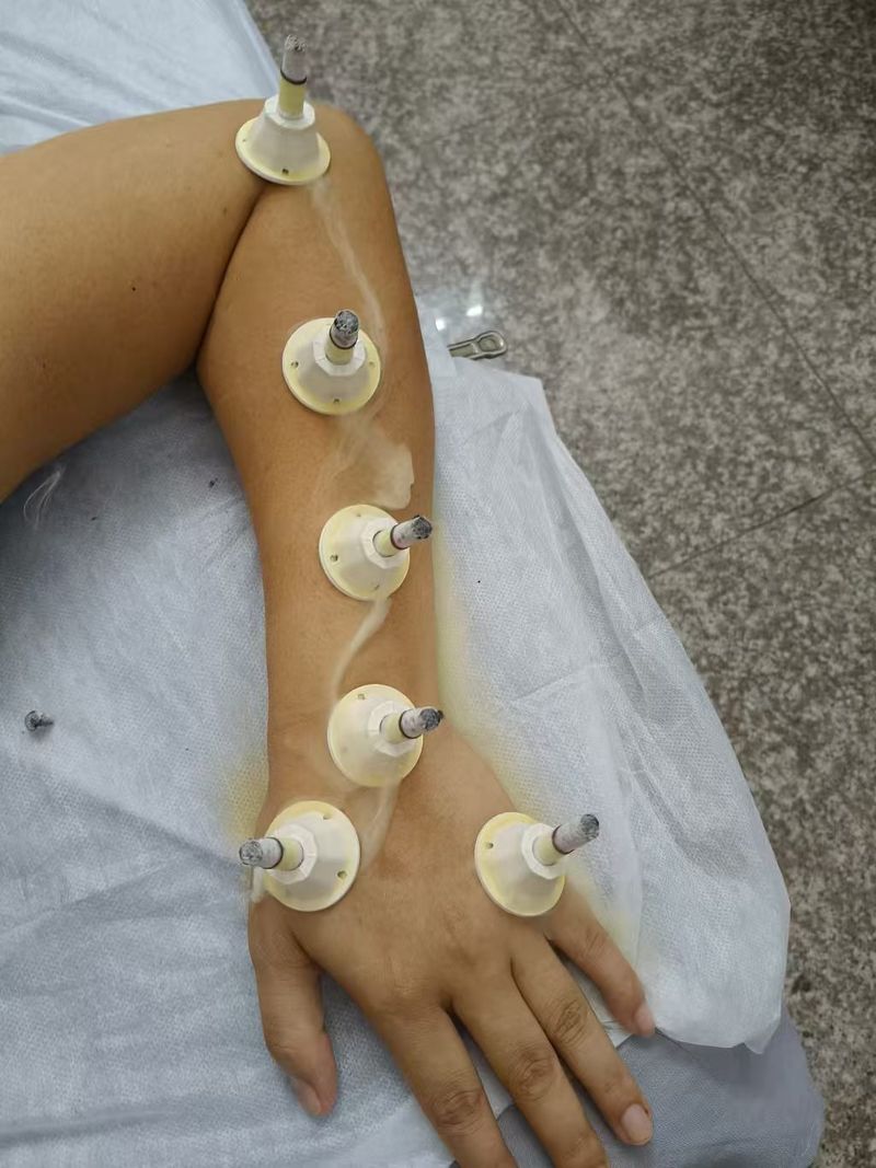 体验艾灸式养护  帮助改善暂时性身体浮肿  舒缓疲劳  获得深度放松   Enjoy moxibustion‑inspired wellness, help reduce temporary water‑retention puffiness and relieve fatigue for deep relaxation.