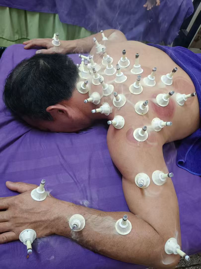 体验艾灸式养护  帮助改善暂时性身体浮肿  舒缓疲劳  获得深度放松   Enjoy moxibustion‑inspired wellness, help reduce temporary water‑retention puffiness and relieve fatigue for deep relaxation.