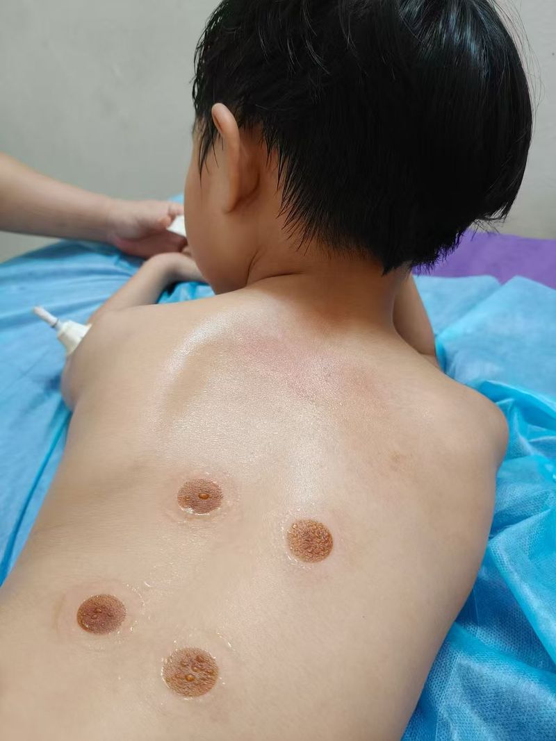 体验艾灸式养护  帮助改善暂时性身体浮肿  舒缓疲劳  获得深度放松   Enjoy moxibustion‑inspired wellness, help reduce temporary water‑retention puffiness and relieve fatigue for deep relaxation.