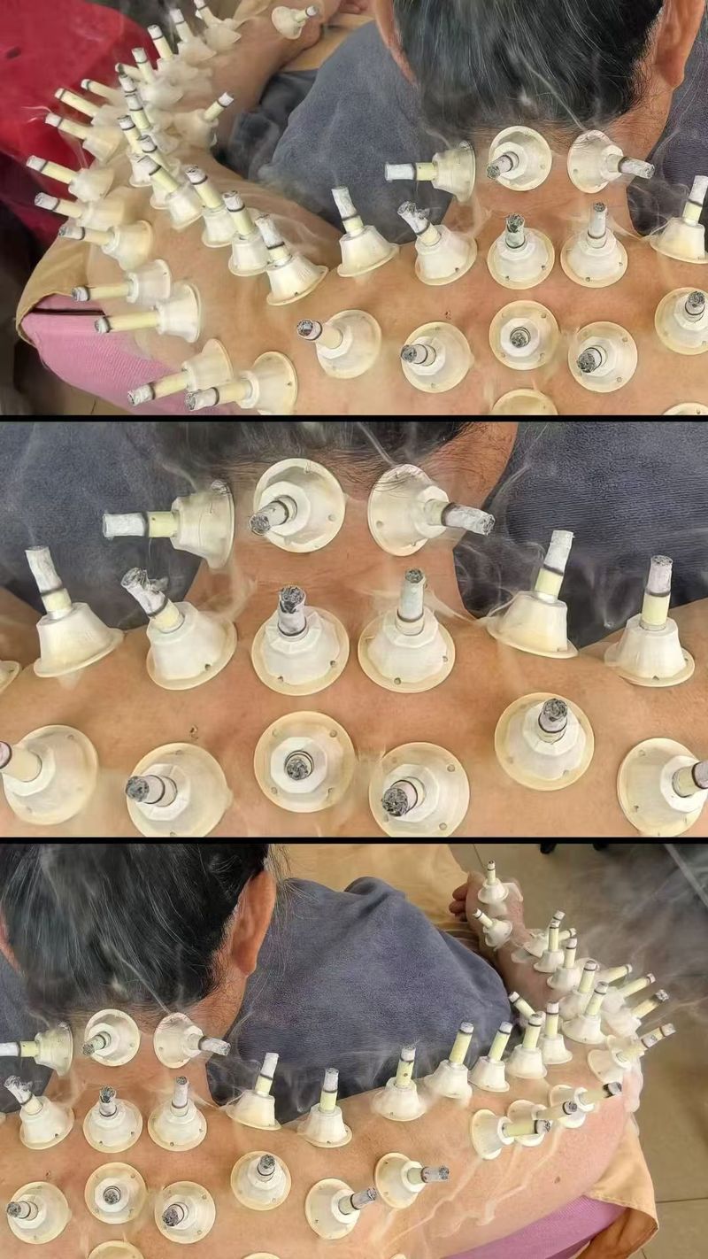 体验艾灸式养护  帮助改善暂时性身体浮肿  舒缓疲劳  获得深度放松   Enjoy moxibustion‑inspired wellness, help reduce temporary water‑retention puffiness and relieve fatigue for deep relaxation.