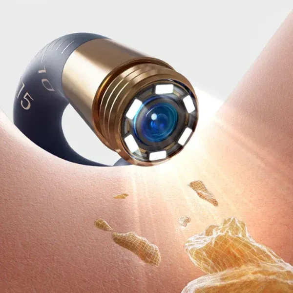 ⏳50%OFF⏳ Visual Arc Ear Wax Removal Kit